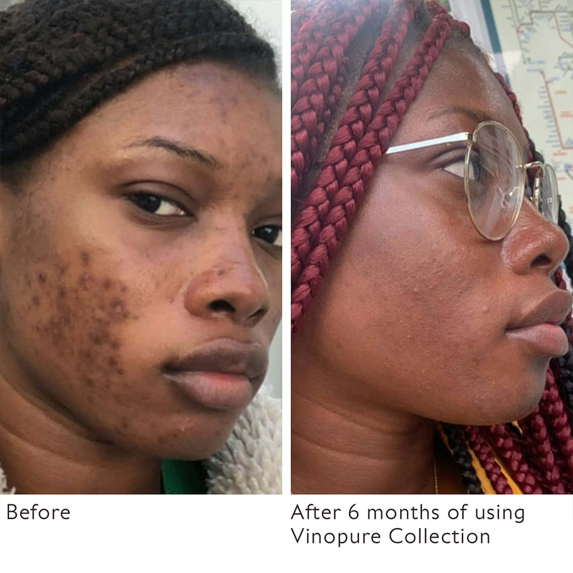 Caudalie Vinopure Serum