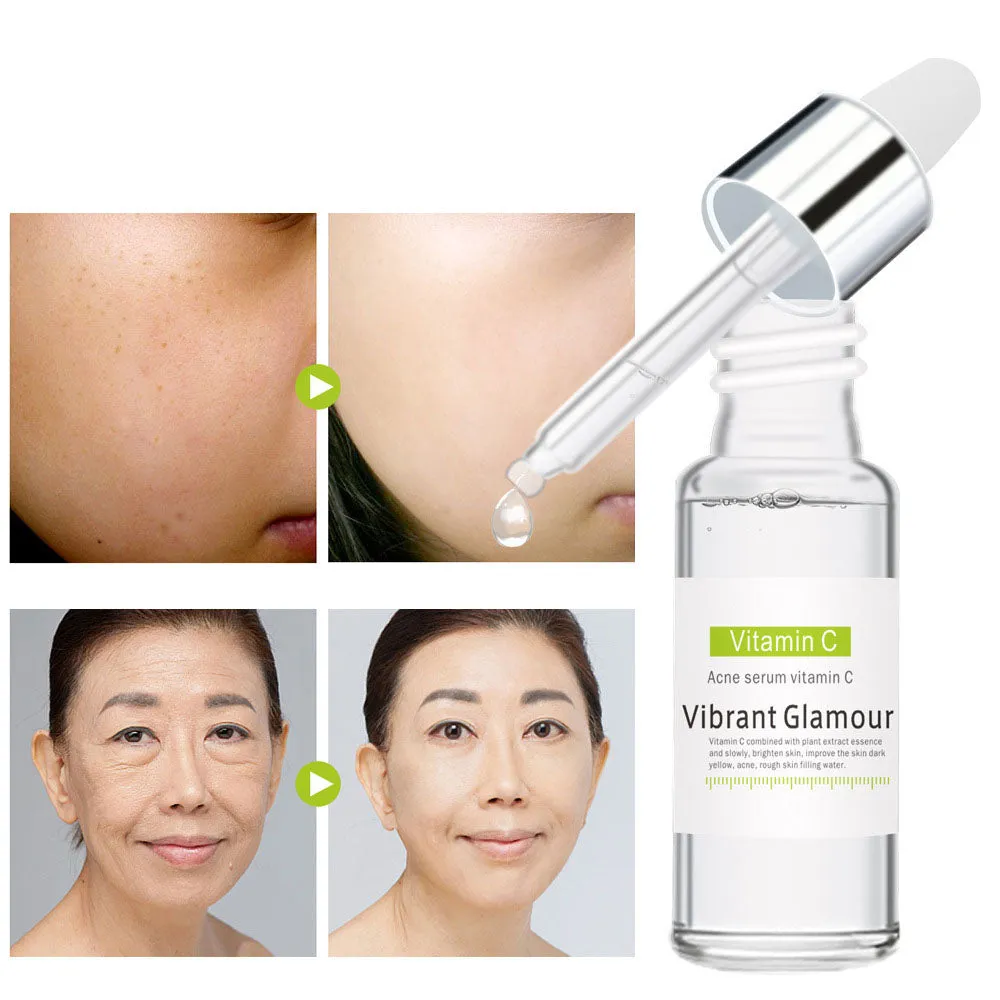 Vitamin C Acne Essence – Pore Minimizing & Hydrating Serum