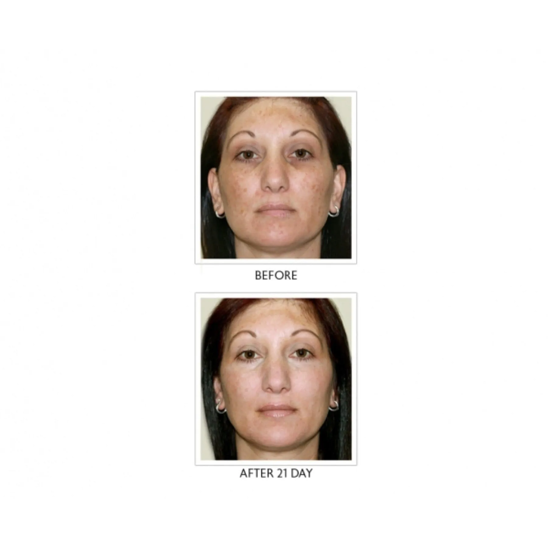 Wrinkle Zero Night Renewal Serum- Retinol- Vitamin C -Growth factors- Peptides